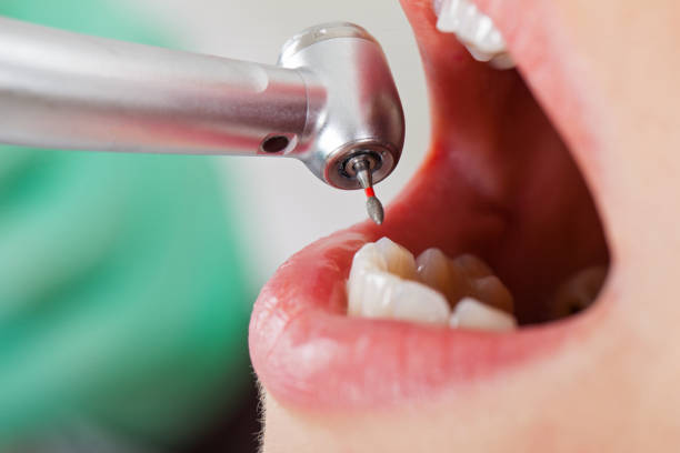 Best Urgent Dental Care in Saranac, MI